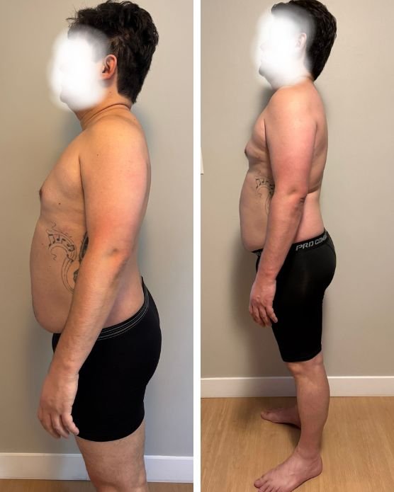 Antes e depois grade