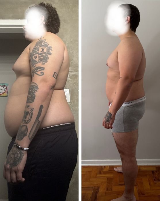 Antes e depois grade