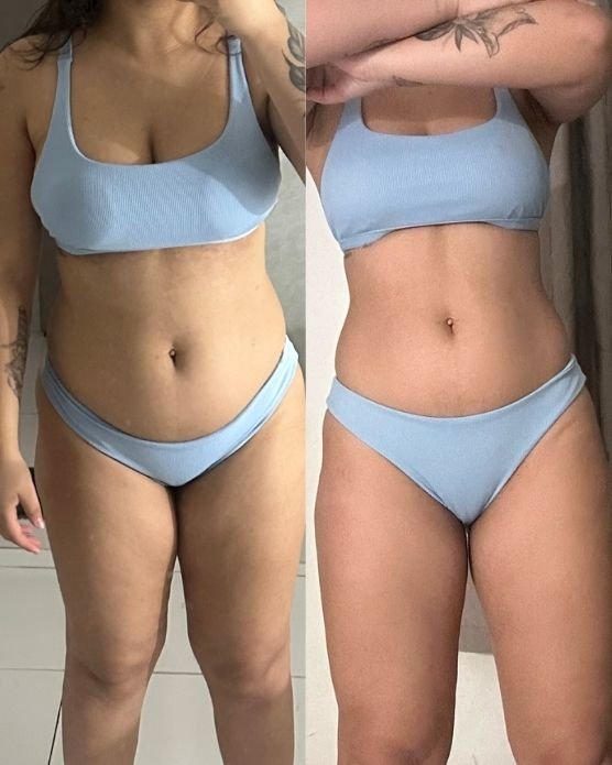 Antes e depois grade